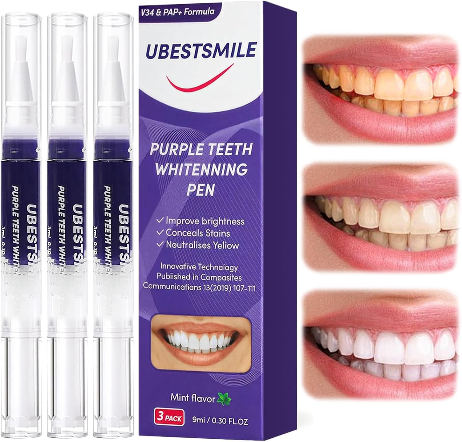 UBESTSMILE V34&PAP+ Formula Fi – Teeth Whitening Kit recenzja i cena
