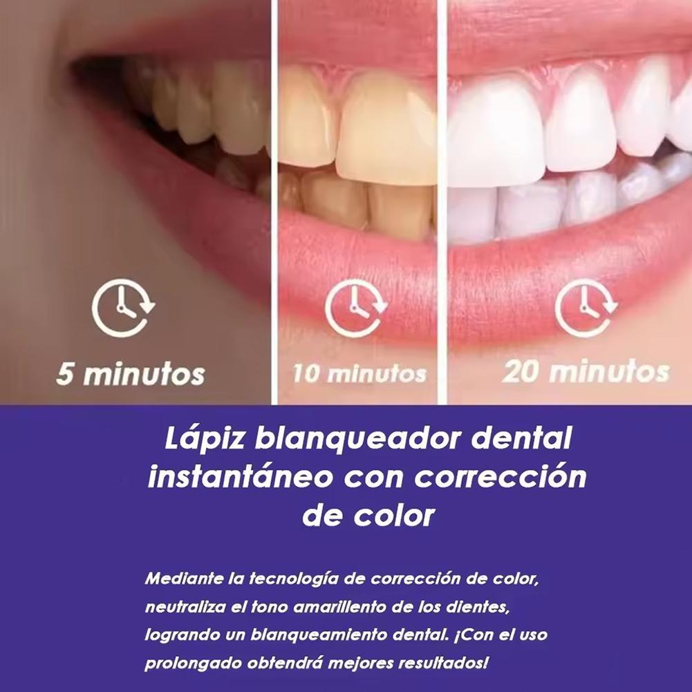 UBESTSMILE V34&PAP+ Formula Fi – Teeth Whitening Kit recenzja i cena